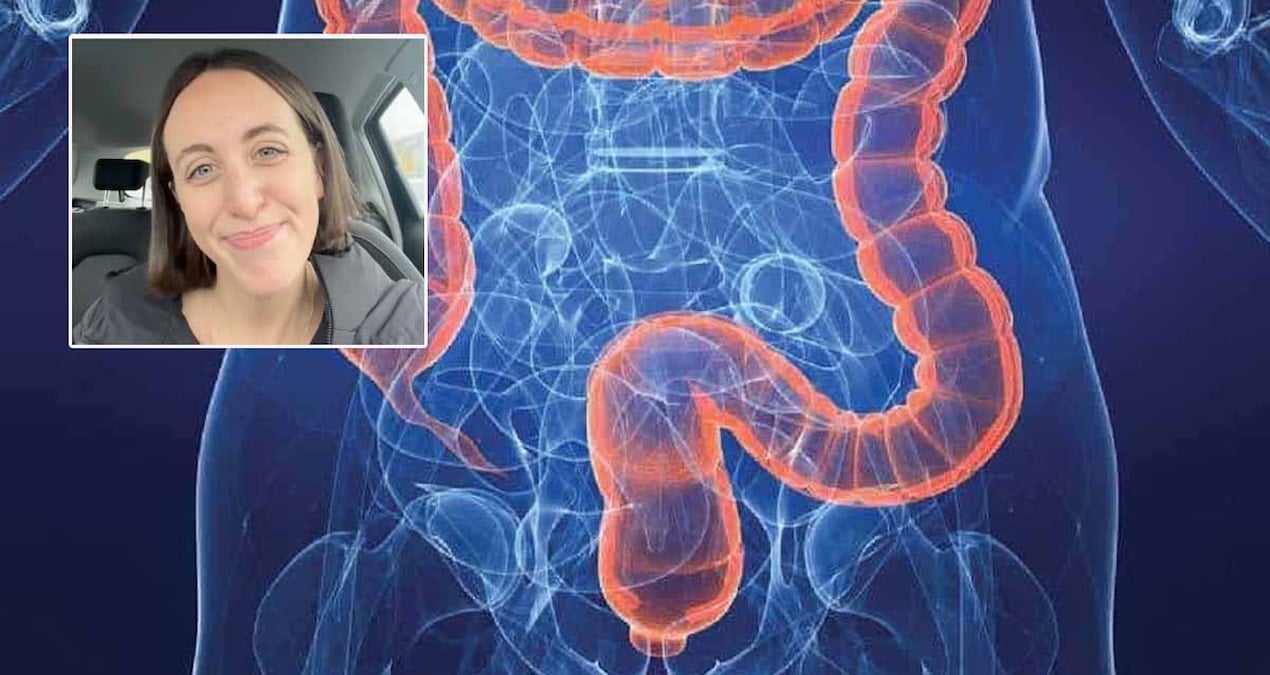 henuz 25 yasinda kolon kanserine yakalandi bana olmaz demeyin diyerek kendisinde gordugu 4 belirtiyi siraladi j7IxGzz2